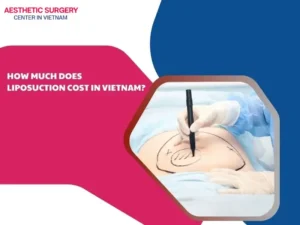Liposuction vietnam price