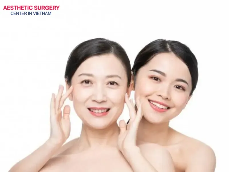 A facelift significantly improves skin structure, giving you firmer skin