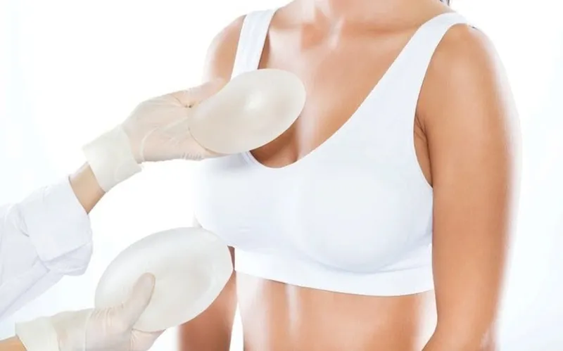 Breast augmentation helps you achieve fuller breasts