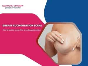 breast augmentation scars