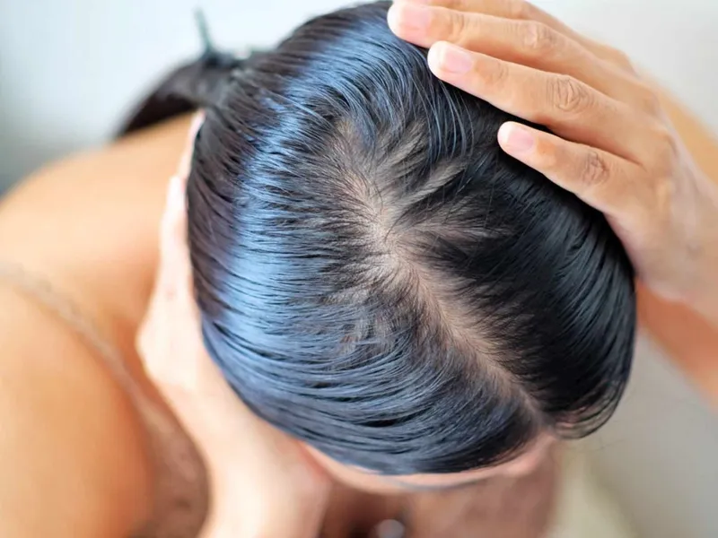 Post-operative hair care is key to long-lasting results