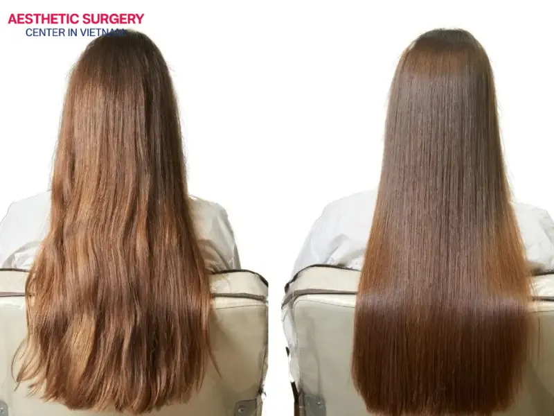 There are multiple factors that affect the hair botox treatment price in Vietnam