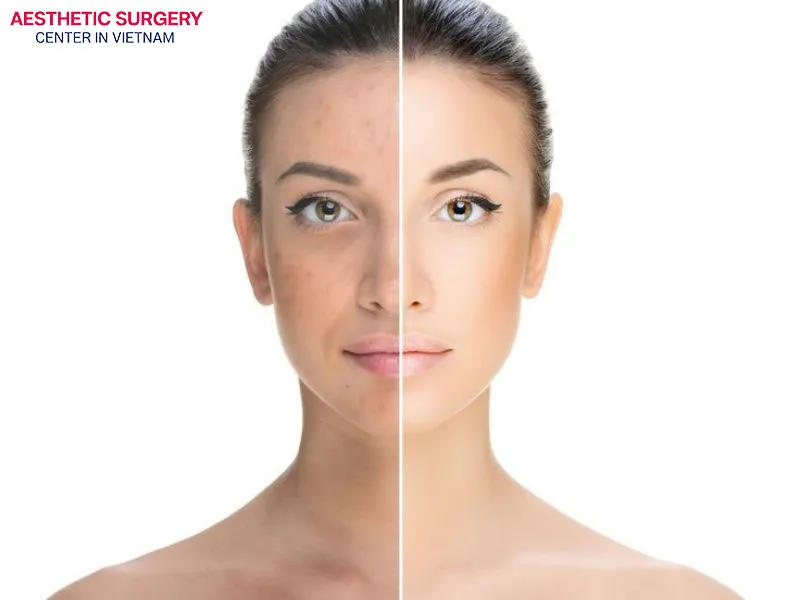 Individuals with mild skin aging can use this method to achieve firmer, more radiant skin