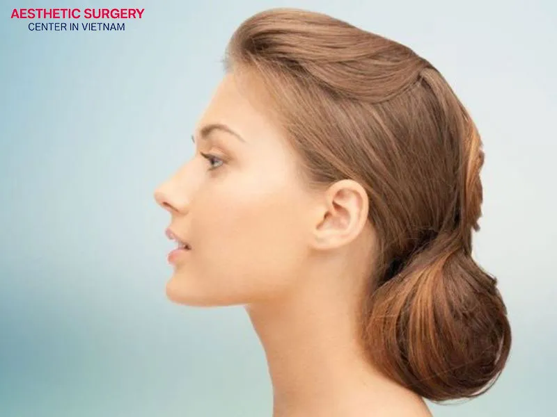 Rhinoplasty has become a popular cosmetic surgery service in Vietnam in recent years