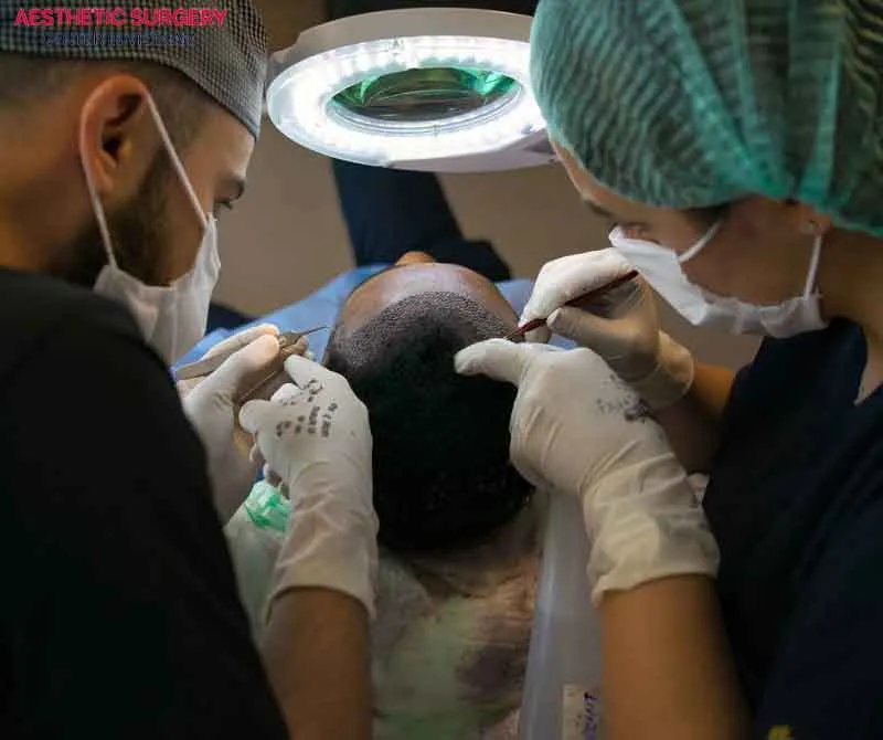 A hair transplant performed by a skilled surgeon ensures safety and minimal complications 