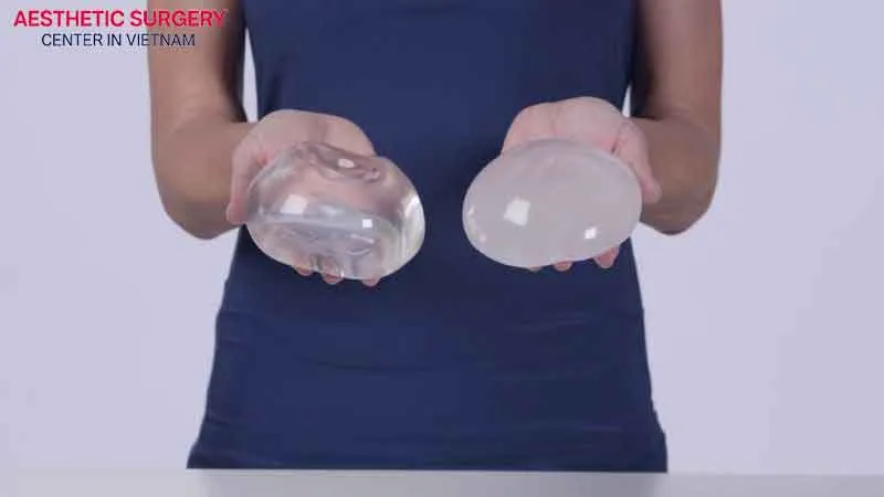 Silicone and saline implants have different characteristics 
