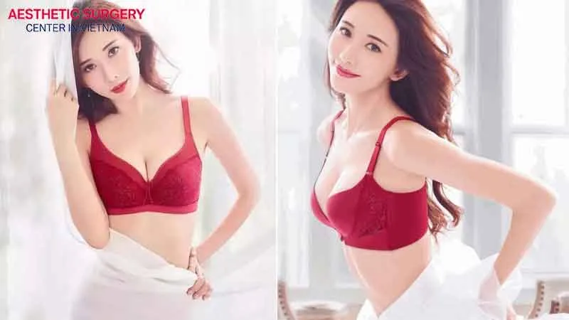 Breast augmentation helps women feel more confident about their appearance