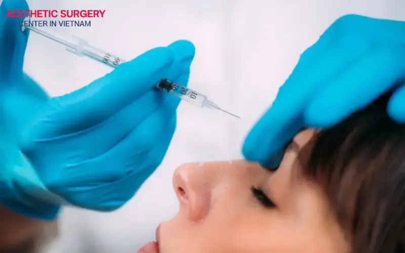 Liquid rhinoplasty is often indicated to effectively fill depressions along the nasal bridge