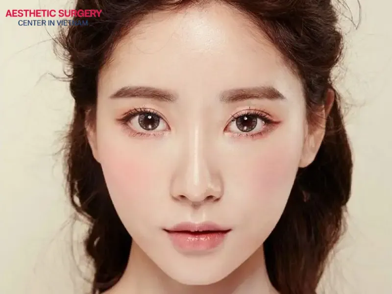 Choosing to have double eyelid surgery in Vietnam allows you to save significantly while still ensuring safety and quality
