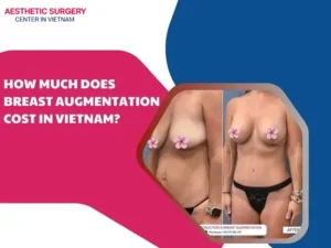 Breast augmentation cost in vietnam