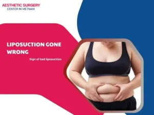 Liposuction gone wrong