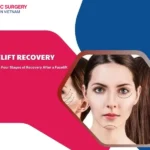 Facelift recovery