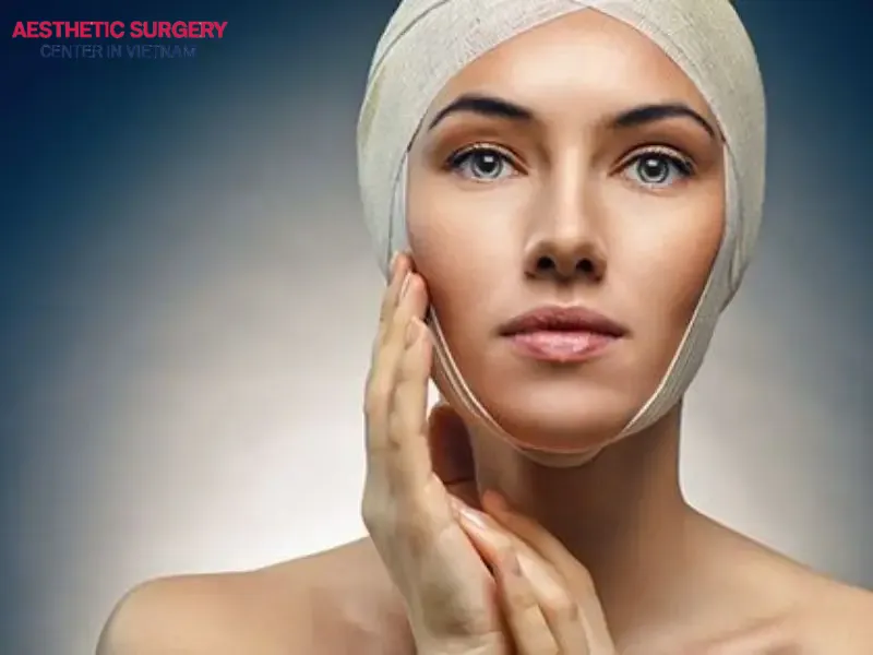 Facelift results are not permanent and typically last around 5–7 years