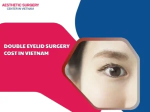 Double eyelid surgery cost in Vietnam