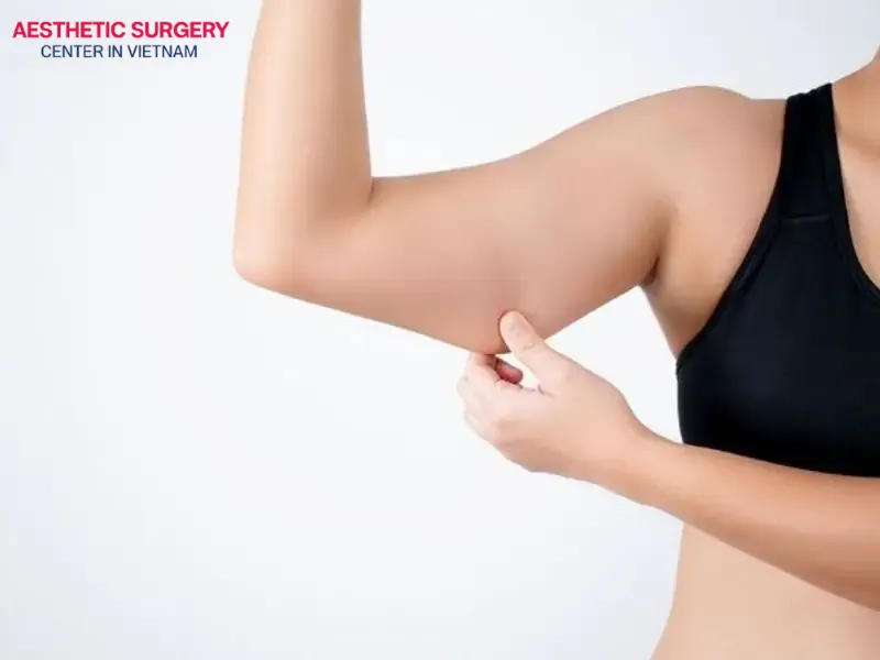 The degree of skin aging and elasticity in the arms can significantly impact the outcome of arm liposuction
