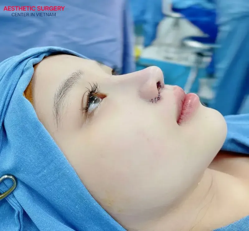 Curved line nose is a popular Korean-style nose shape