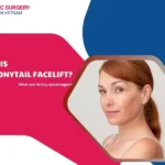 What is ponytail facelift