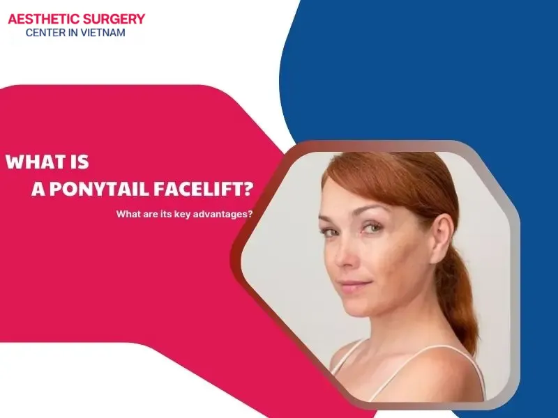 What is ponytail facelift