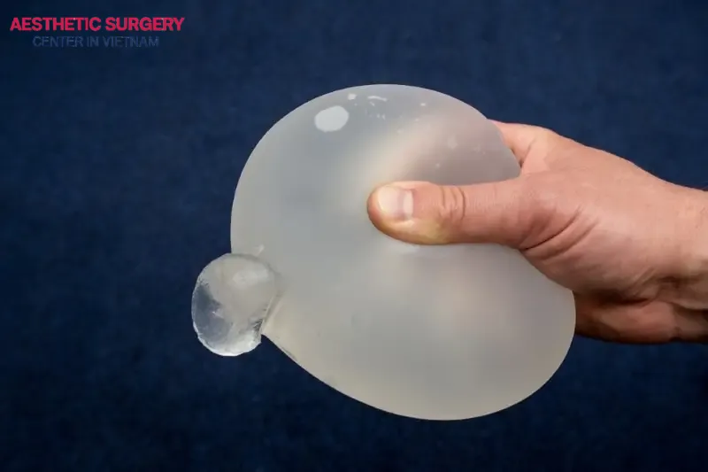 The filler material in silicone breast implants is made of cohesive silicone gel to provide the most natural feel