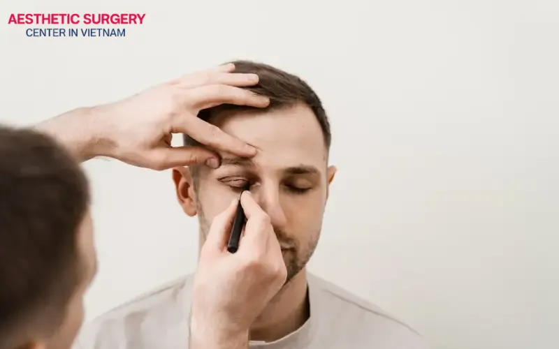 Individuals aged 30 and above showing signs of aging and sagging eyelid skin are suitable candidates for blepharoplasty