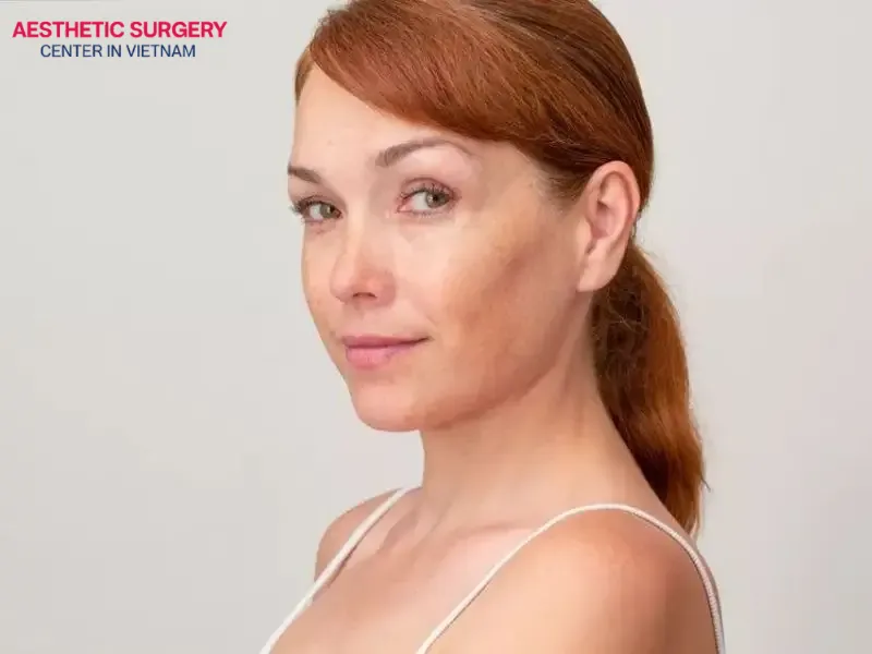 The ponytail facelift is a comprehensive, minimally invasive rejuvenation solution suitable for individuals aged 30 - 45