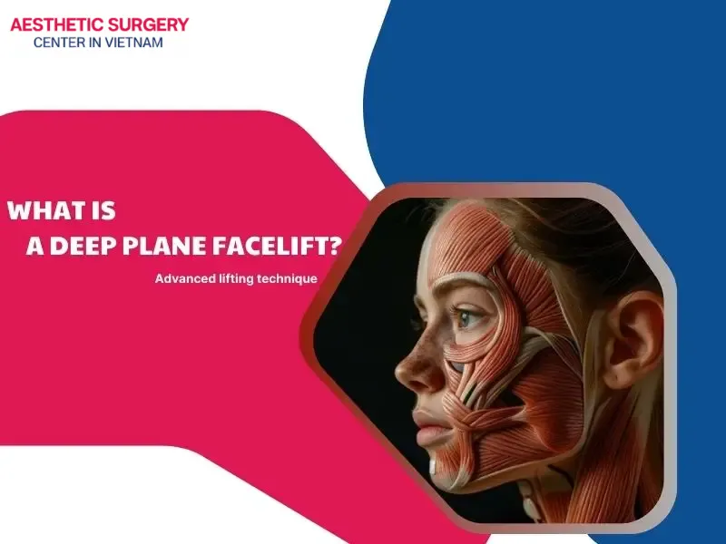 What is a deep plane facelift