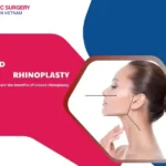 Closed rhinoplasty