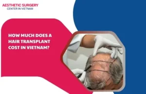 Average cost of hair transplants in vietnam