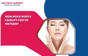 Facelift cost in vietnam