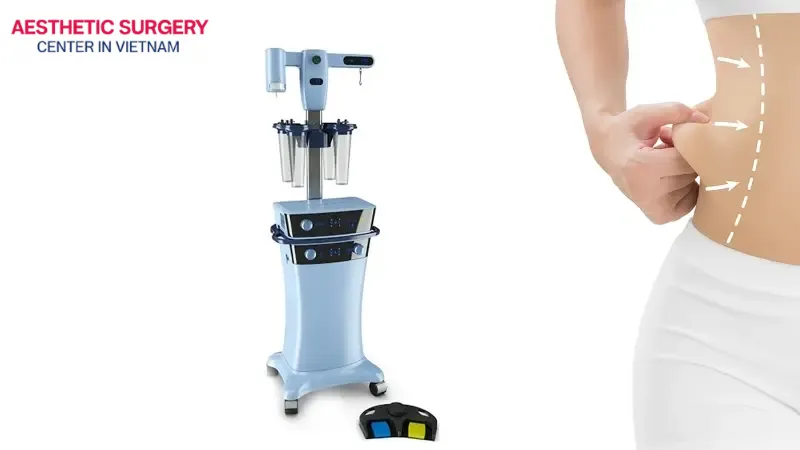Vaser Lipo uses high-frequency ultrasound waves to liquefy fat cells