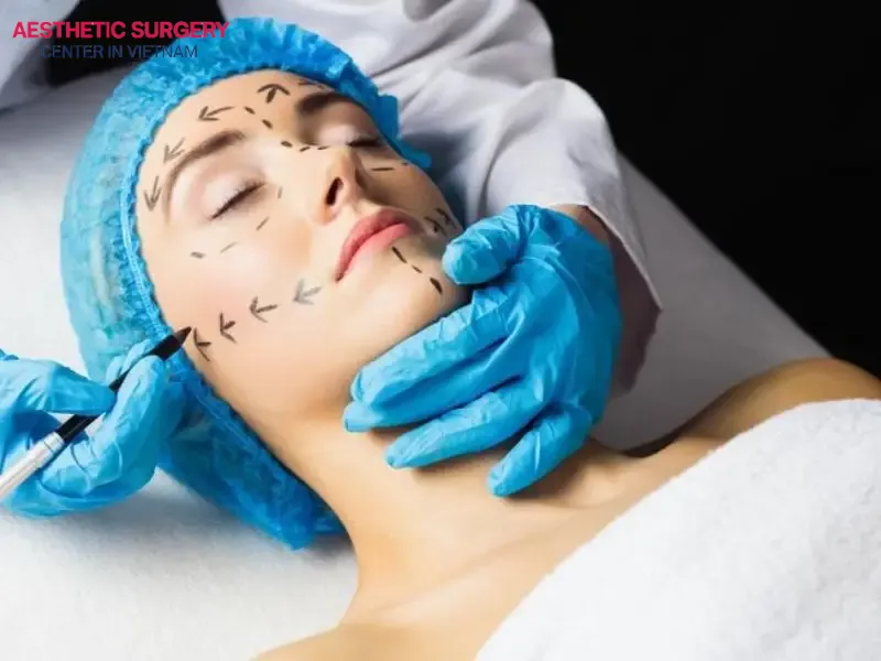Mini facelift surgery is performed by highly qualified doctors