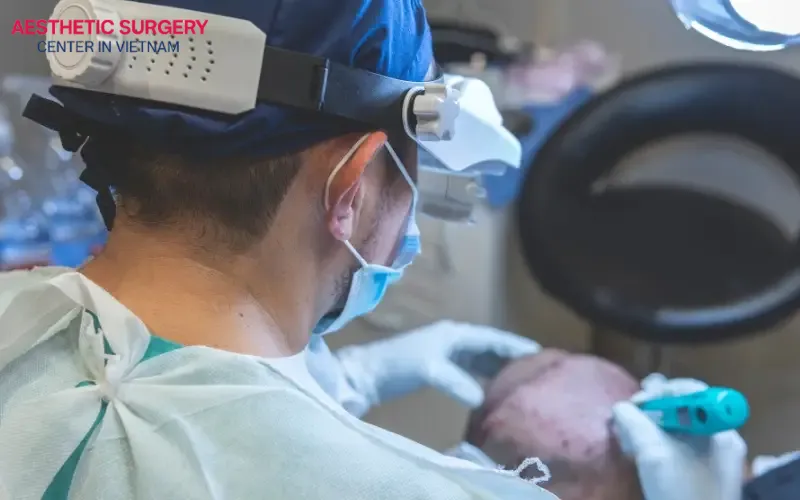 The cost of hair transplant for women also depends on each person’s scalp condition and the number of grafts required