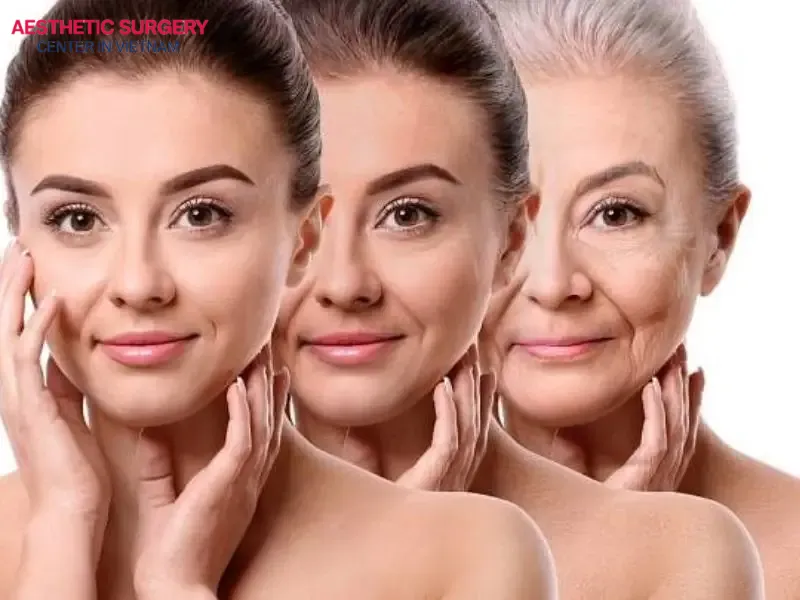 Mini facelift provides clear aesthetic benefits with many outstanding advantages