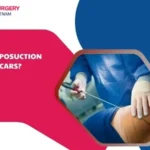 Does liposuction leave scars
