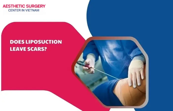 Does liposuction leave scars