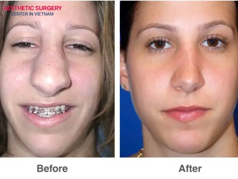 Aesthetics Surgery Center takes pride in its team of highly experienced surgeons who are dedicated to every patient through each surgical procedure
