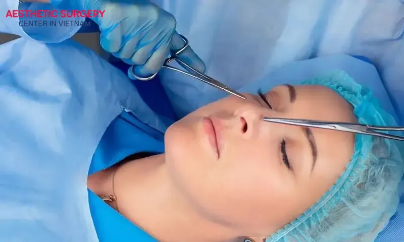 Rhinoplasty is a surgical procedure that often makes many people feel concerned before undergoing it