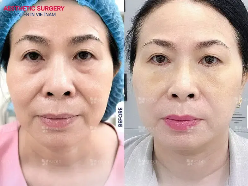 Aesthetic Surgery Center is a cosmetic clinic trusted by both domestic and international clients