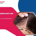 Hair transplant for women