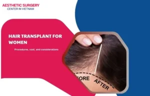 Hair transplant for women