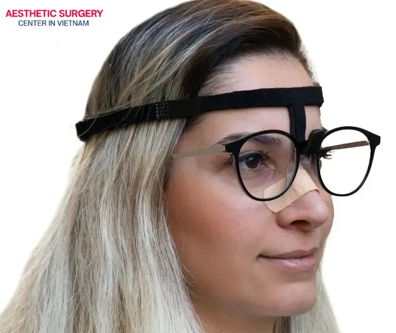 You can use post-surgery support glasses to avoid putting pressure on the nasal bridge