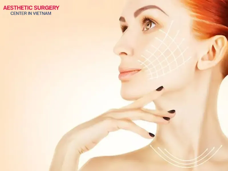 Mini facelift works by targeting multiple facial muscle groups for noticeable results