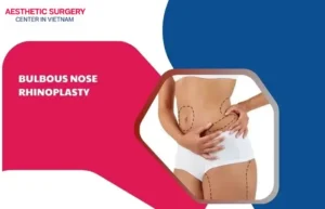 Liposuction recovery time