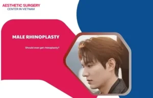 Male rhinoplasty