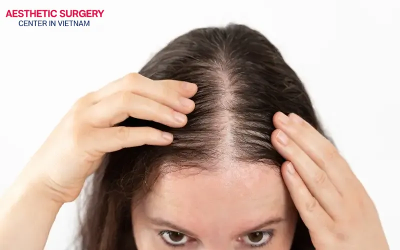 Hair loss in women can stem from many different causes related to hormones and medical conditions