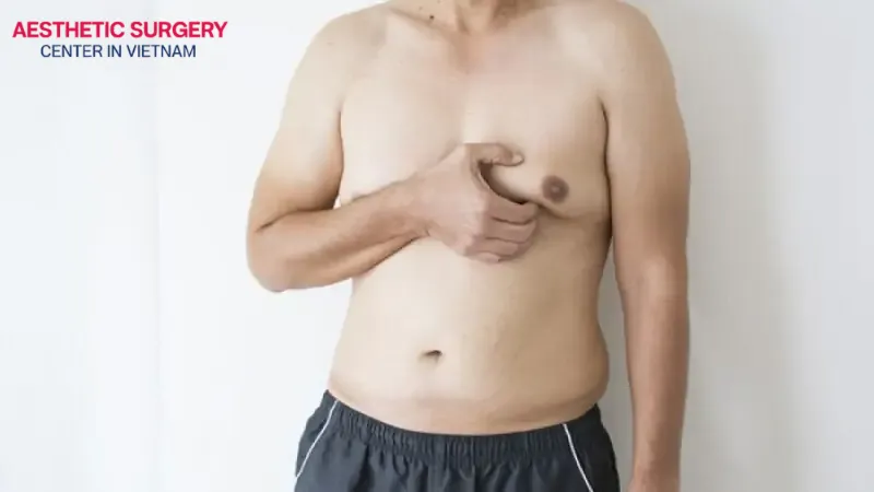 You should carefully consider your options before deciding on surgery