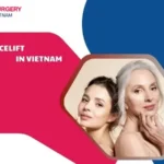 Facelift in Vietnam