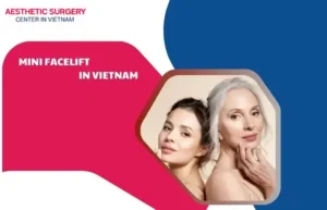 Facelift in Vietnam