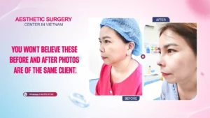 YOU WON'T BELIEVE THESE BEFORE AND AFTER PHOTOS AR