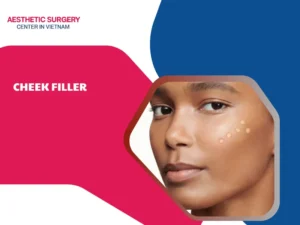 Cheek Filler